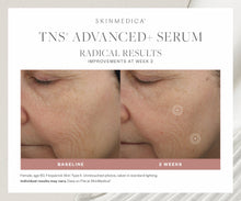 SkinMedica® TNS Advanced+ Serum